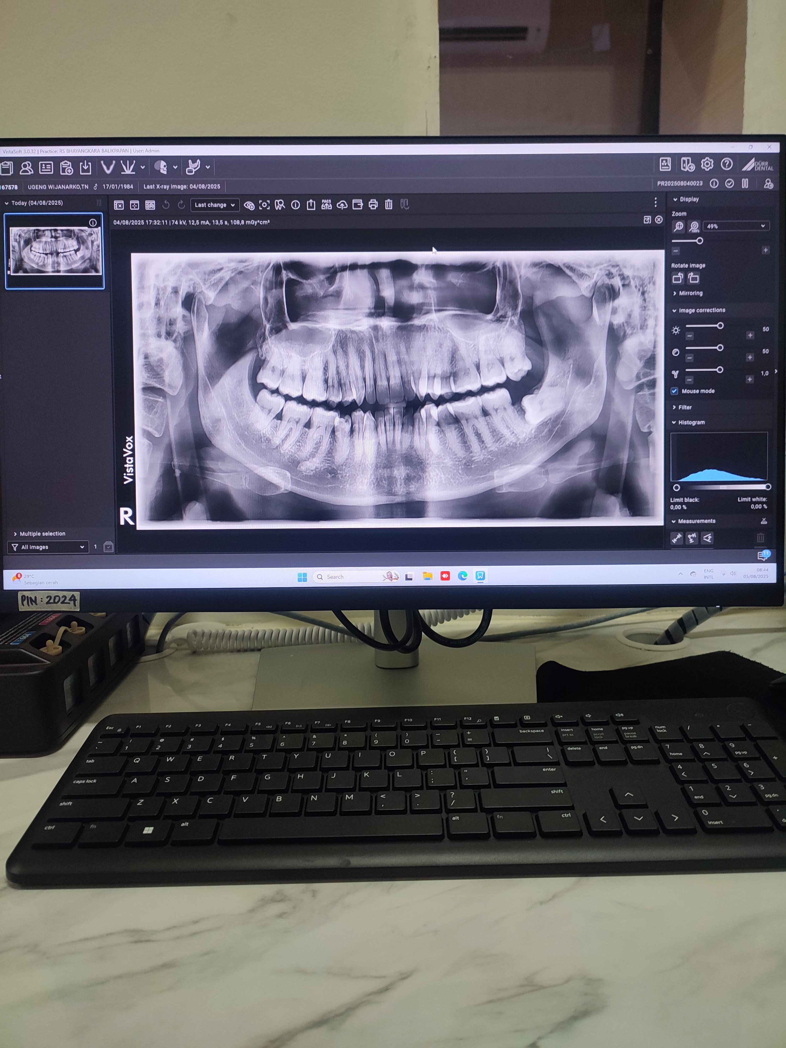 Foto Radiologi 8